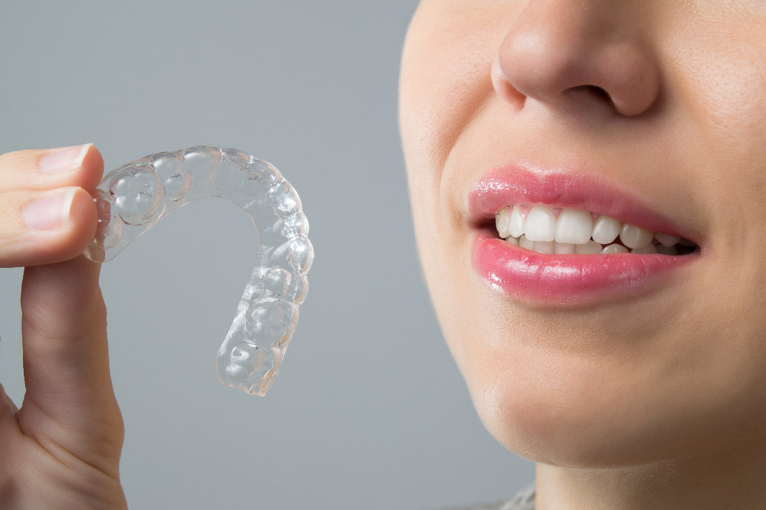 Invisible Braces Solihull