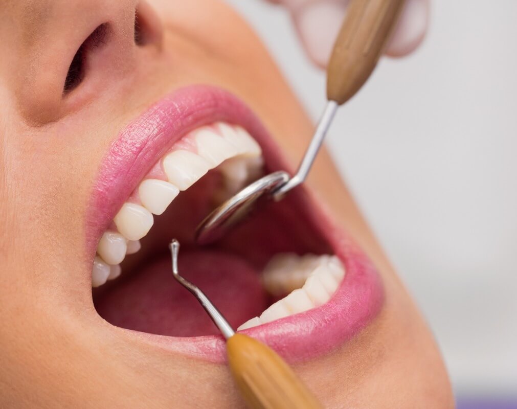 Dental Hygiene Services Solihull