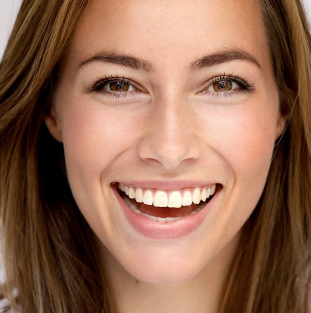 Dental Veneers