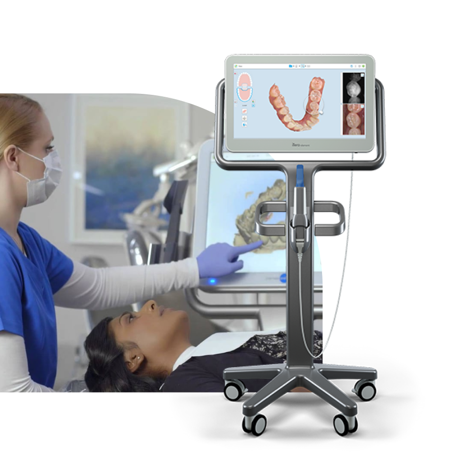  Itero Scanner 