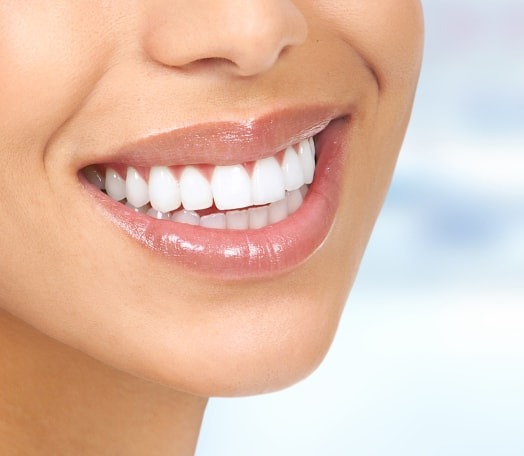 Dental Veneers Solihull
